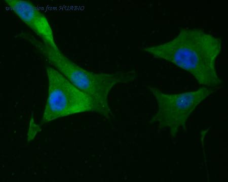 HUABIO R1510-7 image 1