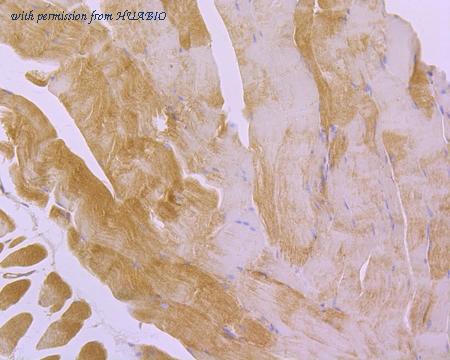 HUABIO R1510-7 image 2