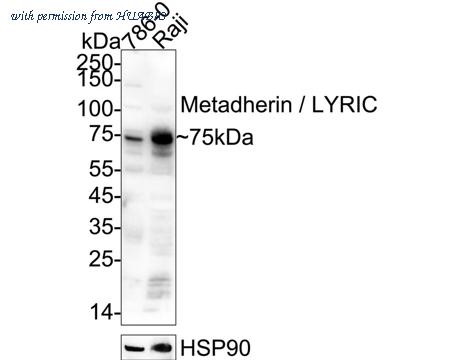 HUABIO R1511-10 image 1