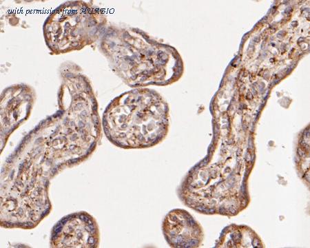 HUABIO R1511-11 image 3