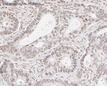 HUABIO R1511-17 image 2