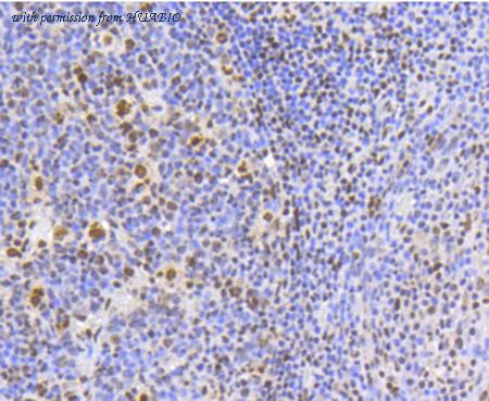 HUABIO R1511-17 image 3