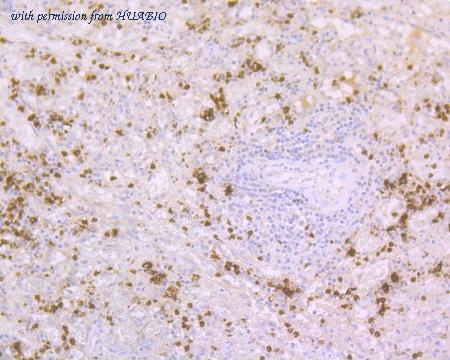 HUABIO R1511-19 image 2