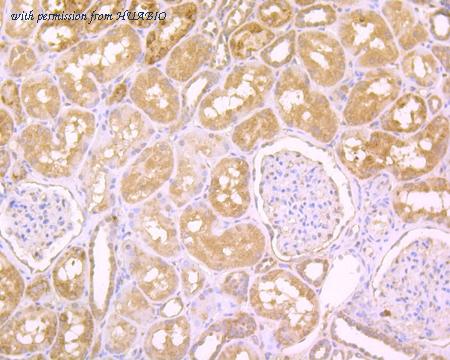 HUABIO R1511-19 image 3