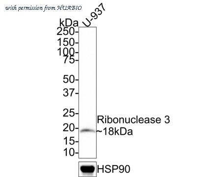 HUABIO R1511-20 image 2