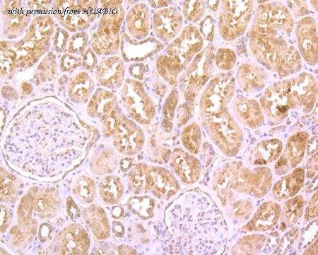 HUABIO R1511-21 image 1