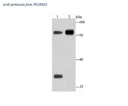 HUABIO R1511-23 image 1
