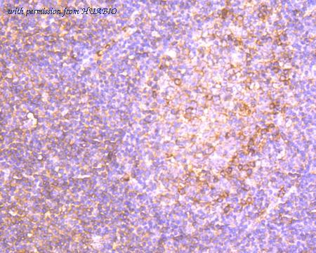 HUABIO R1511-23 image 2