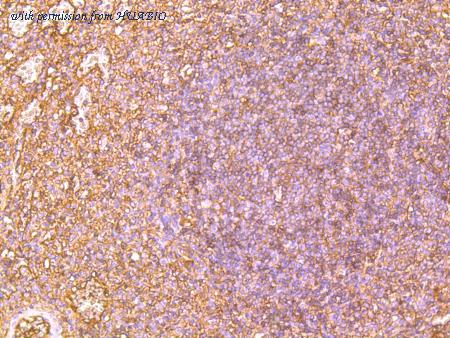 HUABIO R1511-23 image 3