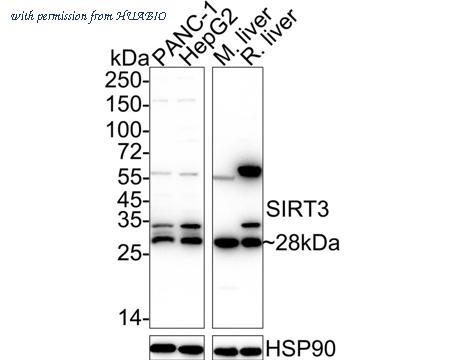 HUABIO R1511-3 image 1
