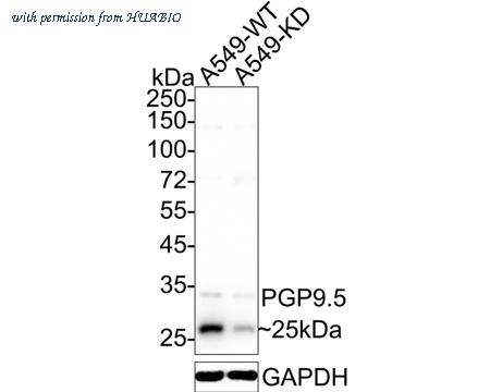 HUABIO R1511-8 image 1
