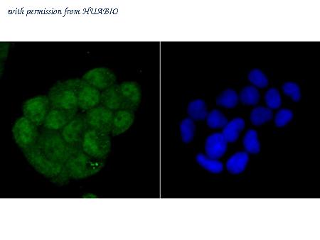 HUABIO R1512-17 image 2