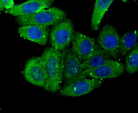 HUABIO R1601-1 image 2