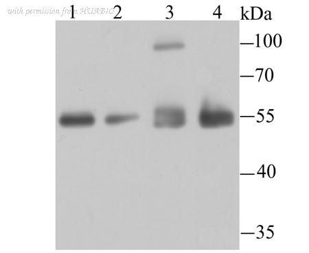 HUABIO R1601-7 image 1