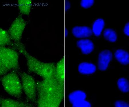 HUABIO R1701-1 image 2