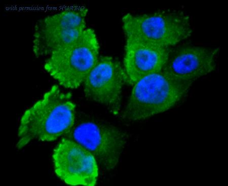 HUABIO R1701-3 image 2