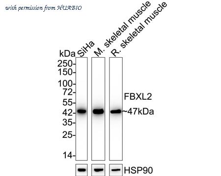 HUABIO R1706-15 image 1