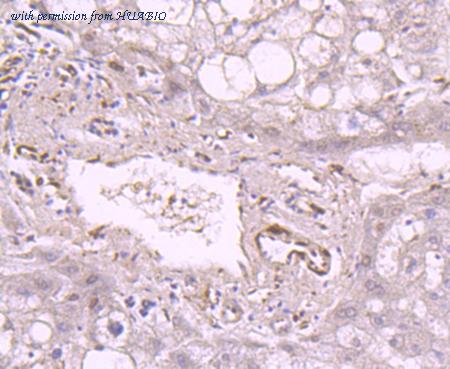 HUABIO R1706-3 image 2