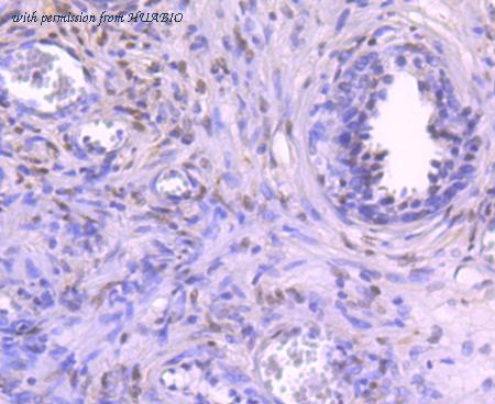 HUABIO R1706-3 image 3