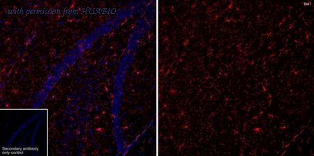 HUABIO HA601368 image 3