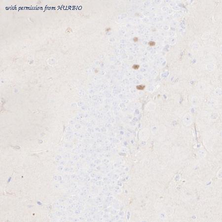 HUABIO HA601373 image 3