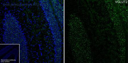 HUABIO HA601393 image 1