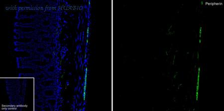 HUABIO HA601405 image 1