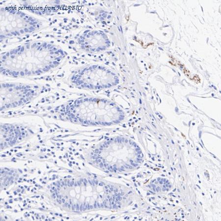 HUABIO HA601405 image 2