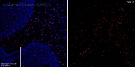 HUABIO HA601413 image 2