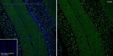 HUABIO HA601421 image 1