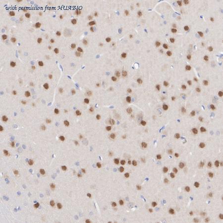 HUABIO HA601422 image 3