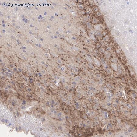 HUABIO HA601423 image 2