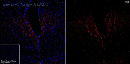 HUABIO HA601425 image 1