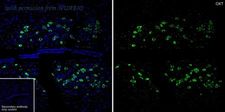 HUABIO HA601426 image 2