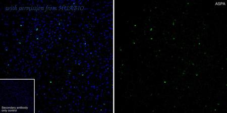 HUABIO HA601430 image 1