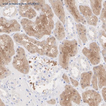 HUABIO HA601430 image 2