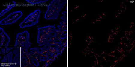 HUABIO HA601446 image 1