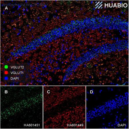 HUABIO HA601449 image 1