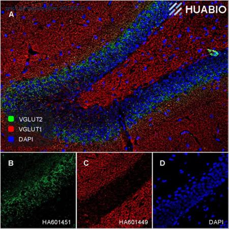 HUABIO HA601449 image 2