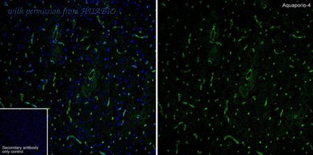 HUABIO HA601460 image 1