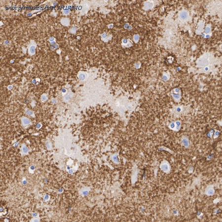 HUABIO HA601462 image 2