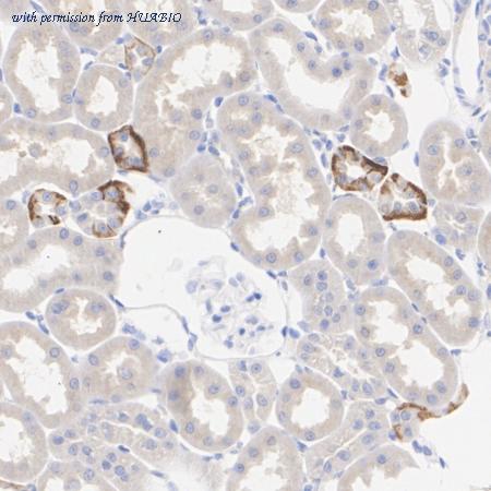 HUABIO HA601462 image 3