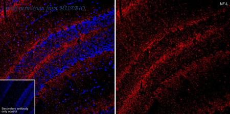 HUABIO HA601463 image 1