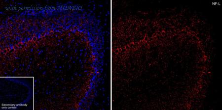 HUABIO HA601463 image 2