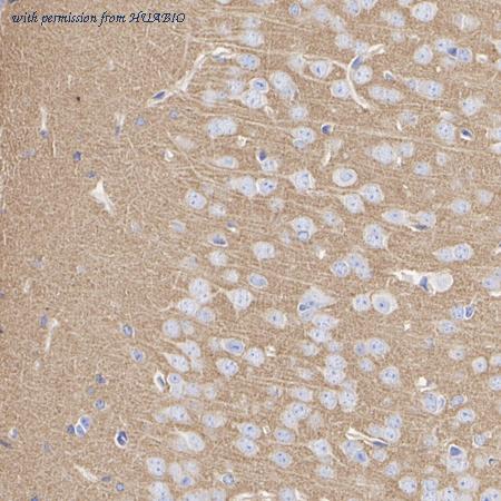 HUABIO HA601466 image 2