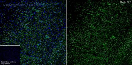 HUABIO HA601470 image 1