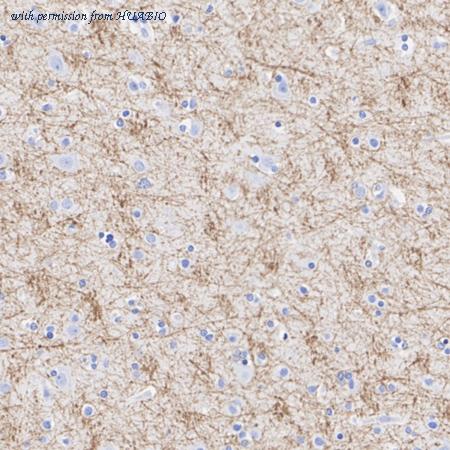 HUABIO HA601470 image 2