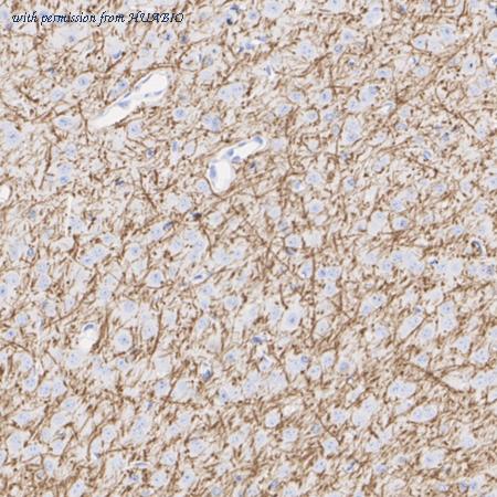 HUABIO HA601470 image 3