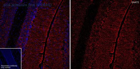 HUABIO HA601504 image 1