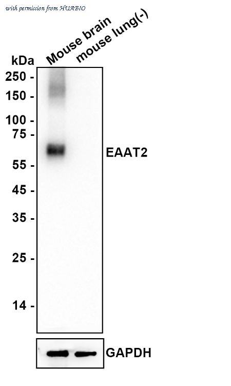HUABIO HA601504 image 2